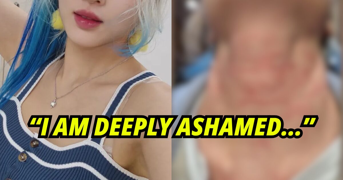 Membro de girl group mostra ferimentos após ataque: empresa desmente história